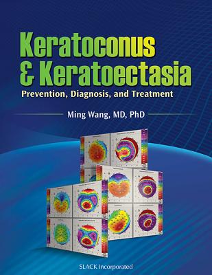 Keratoconus & Keratoectasia: Prevention, Diagnosis, and Treatment - Wang, Ming, MD