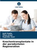 Knochentransplantate in der parodontalen Regeneration