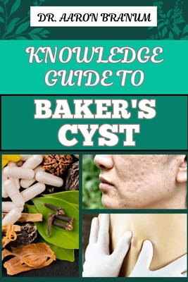 Knowledge Guide to Baker's Cyst: Essential Manual To Symptoms, Diagnosis, Treatment Options, And Prevention For Optimal Knee Health - Branum, Aaron, Dr.