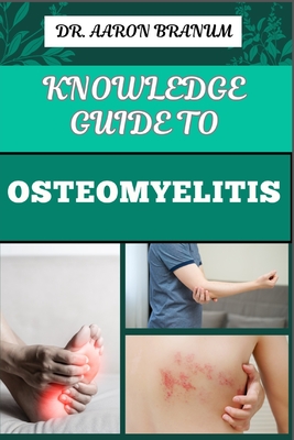 Knowledge Guide to Osteomyelitis: Essential Manual To Diagnosis, Treatment, Prevention, and Advanced Therapies for Bone Infection Management - Branum, Aaron, Dr.