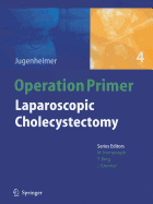 Laparoscopic Cholecystectomy