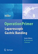 Laparoscopic Gastric Banding