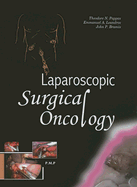 Laparoscopic Surgical Oncology