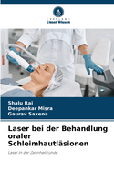 Laser bei der Behandlung oraler Schleimhautlsionen