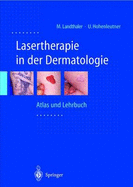 Lasertherapie in Der Dermatologie: Atlas Und Lehrbuch