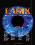 Lasik: Advances, Controversies, and Customs