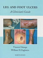 Leg and Foot Ulcers: A Clinician's Guide