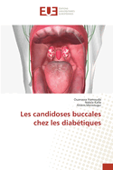 Les candidoses buccales chez les diab?tiques