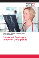 Lesiones ?seas por tracci?n de la pelvis