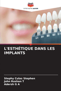 L'Esth?tique Dans Les Implants