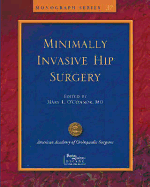 Limited Incisions for Total Hip Arthroplasty - O'Connor, Mary I
