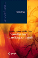 L'Insuffisance Cardiaque Aigue