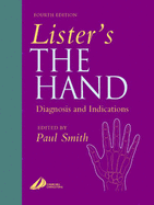 Lister's the Hand: Diagnosis and Indications - Smith, Paul