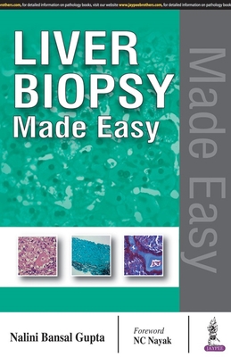 Liver Biopsy Made Easy - Gupta, Nalini Bansal
