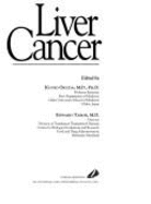 Liver Cancer - Okuda, Kunio, and Tabor, Edward, MD