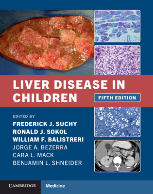 Liver Disease in Children - Suchy, Frederick J (Editor), and Sokol, Ronald J (Editor), and Balistreri, William F (Editor)