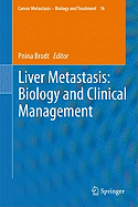 Liver Metastasis: Biology and Clinical Management