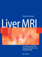 Liver MRI