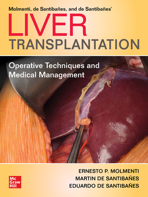 Liver Transplantation: Operative Techniques and Medical Management - Molmenti, Ernesto P., and de Santibaes, Martin, and de Santibaes, Eduardo