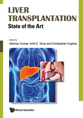 Liver Transplantation: State Of The Art - Humar, Abhinav (Editor), and Tevar, Amit D (Editor), and Hughes, Christopher B (Editor)