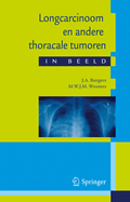 Longcarcinoom En Andere Thoracale Tumoren in Beeld: Casuistiek in Een Breder Perspectief