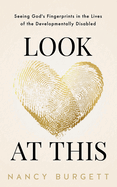 Look at This: Seeing God's Fingerprints in the Lives of the Developmentally Disabled