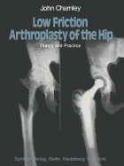 Low Friction Arthroplasty of the Hip: Theory and Practice