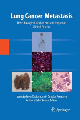 Lung Cancer Metastasis: Novel Biological Mechanisms and Impact on Clinical Practice - Keshamouni, Venkateshwar (Editor), and Arenberg, Douglas (Editor), and Kalemkerian, Gregory (Editor)