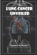 Lung Cancer Unveiled: Empowering Patients, Caregivers, Advocates, Understanding, Managing, Surviving, with Expert Insights, Latest Research, and Practical Strategies for Navigating the Journey