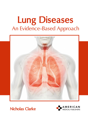 Lung Diseases: An Evidence-Based Approach - Clarke, Nicholas (Editor)