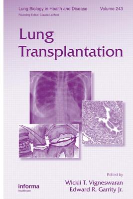 Lung Transplantation - Vigneswaran, Wickii (Editor), and Garrity Jr, Edward R (Editor)