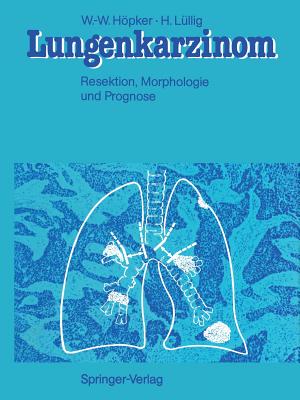 Lungenkarzinom: Resektion, Morphologie Und Prognose - Hpker, Wilhelm-Wolfgang, and Doerr, W (Foreword by), and Linder, F (Foreword by)