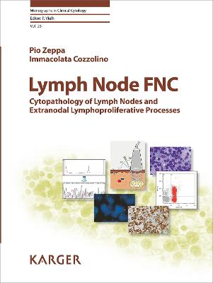 Lymph Node FNC: Cytopathology of Lymph Nodes and Extranodal Lymphoproliferative Processes - Zeppa, P., and Cozzolino, I., and Vielh, Philippe (Series edited by)