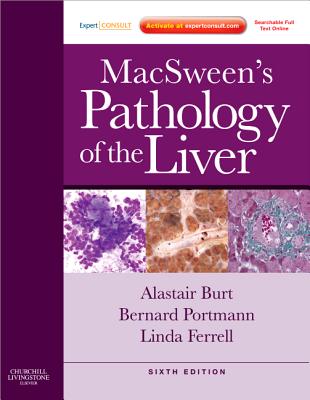 MacSween's Pathology of the Liver - Burt, Alastair D, MD, and Ferrell, Linda D, MD, and Hbscher, Stefan G