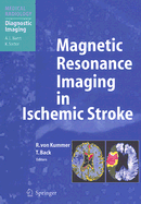 Magnetic Resonance Imaging in Ischemic Stroke