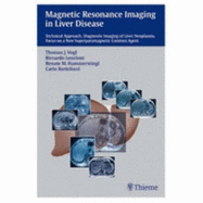 Magnetic Resonance Imaging in Liver Disease: Technical Approach, Diagnostic Imaging of Liver Neoplasms, Focus on a New Superparamagnetic Contrast Agent - Vogl, T.J. (Editor), and et al (Editor), and Lencioni, Riccardo (Editor)