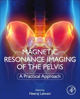 Magnetic Resonance Imaging of the Pelvis: A Practical Approach - Lalwani, Neeraj (Editor)