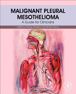 Malignant Pleural Mesothelioma: A Guide for Clinicians - Giordano, Antonio (Editor), and Franco, Renato (Editor)