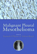 Malignant Pleural Mesothelioma