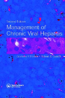 Management of Chronic Viral Hepatitis, Second Edition - Gordon, Stuart