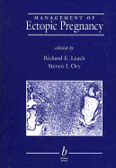 Management of Ectopic Pregnancy - Leach, Richard E (Editor)