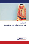 Management of open apex