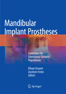 Mandibular Implant Prostheses: Guidelines for Edentulous Geriatric Populations