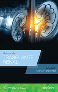 Manual de Trasplante Renal (Sixth, Spanish Language Program)