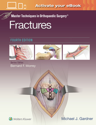 Master Techniques in Orthopaedic Surgery: Fractures - Gardner, Michael J.