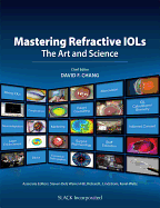 Mastering Refractive Iols: The Art and Science