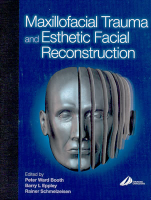 Maxillofacial Trauma and Esthetic Reconstruction - Ward Booth, Peter, Frcs, and Eppley, Barry, MD, DMD, and Schmelzeisen, Rainer, MD, Dds, PhD
