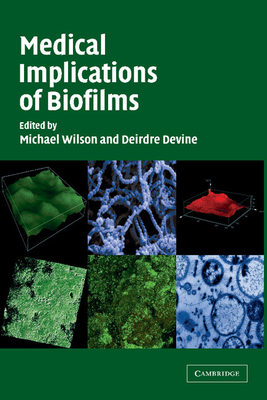 Medical Implications of Biofilms - Wilson, Michael (Editor), and Devine, Deirdre (Editor)