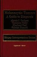 Melanocytic Tumors: A Guide to Diagnosis