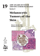 Melanocytic Tumors of Skin